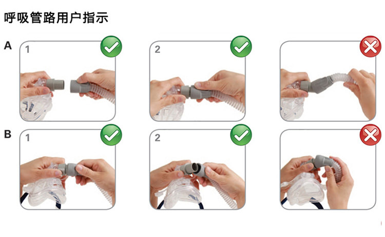 瑞思邁呼吸機(jī)VPAP IV ST 全自動雙水平 有效治療慢阻肺/肺心病/呼吸功能不全